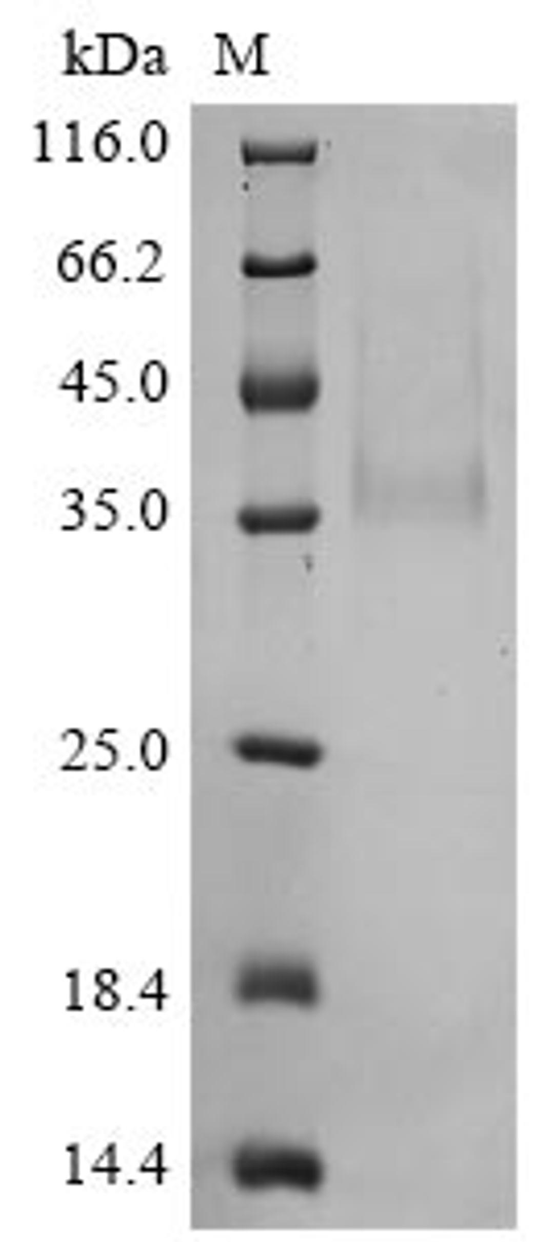 (Tris-Glycine gel) Discontinuous SDS-PAGE (reduced) with 5% enrichment gel and 15% separation gel.