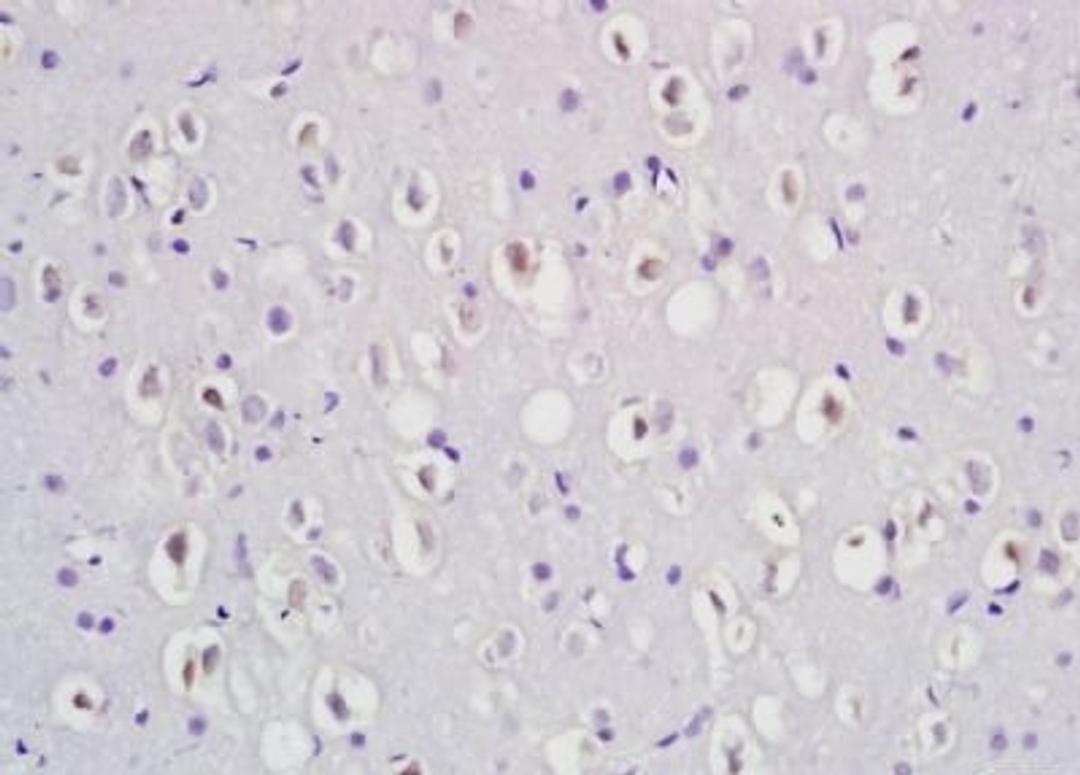 Immunohistochemical analysis of formalin-fixed paraffin embedded rat brain tissue using Dab1 (phospho-Tyr232) antibody (dilution at 1:200)