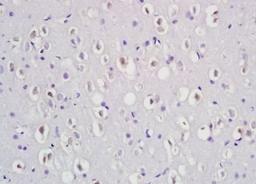 Immunohistochemical analysis of formalin-fixed paraffin embedded rat brain tissue using Dab1 (phospho-Tyr232) antibody (dilution at 1:200)