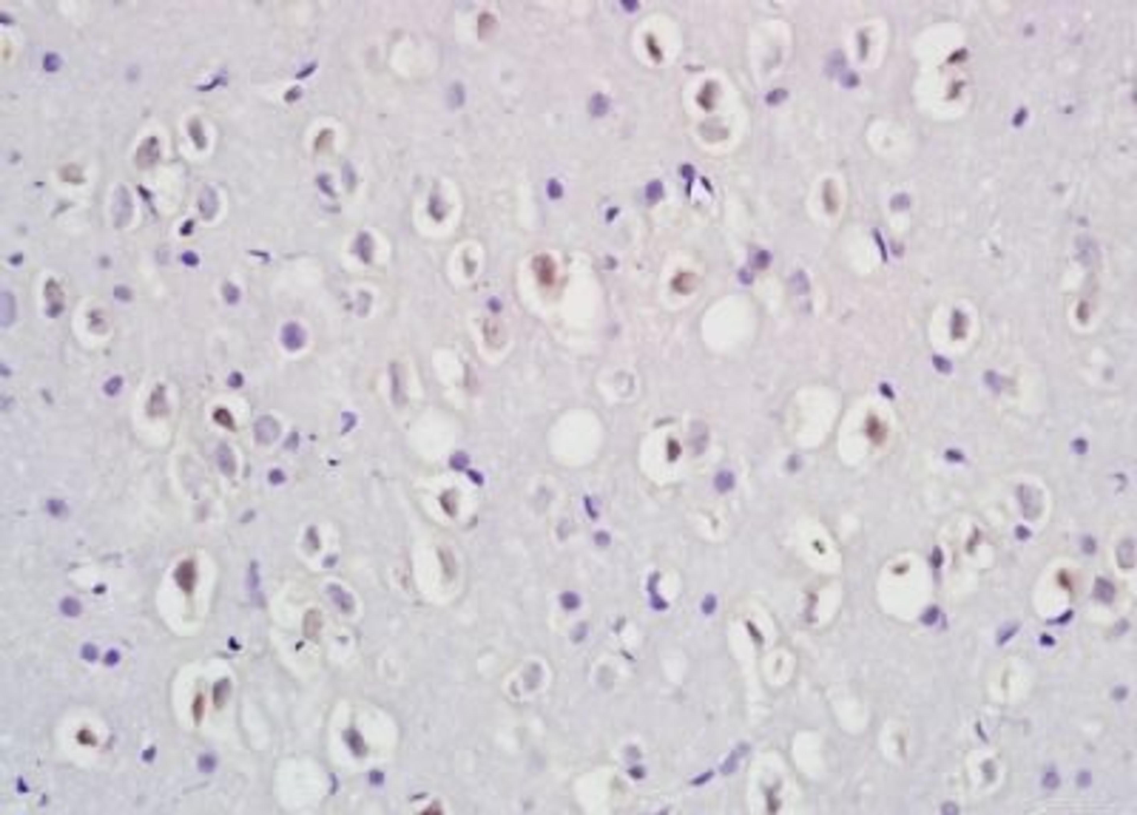 Immunohistochemical analysis of formalin-fixed paraffin embedded rat brain tissue using Dab1 (phospho-Tyr232) antibody (dilution at 1:200)