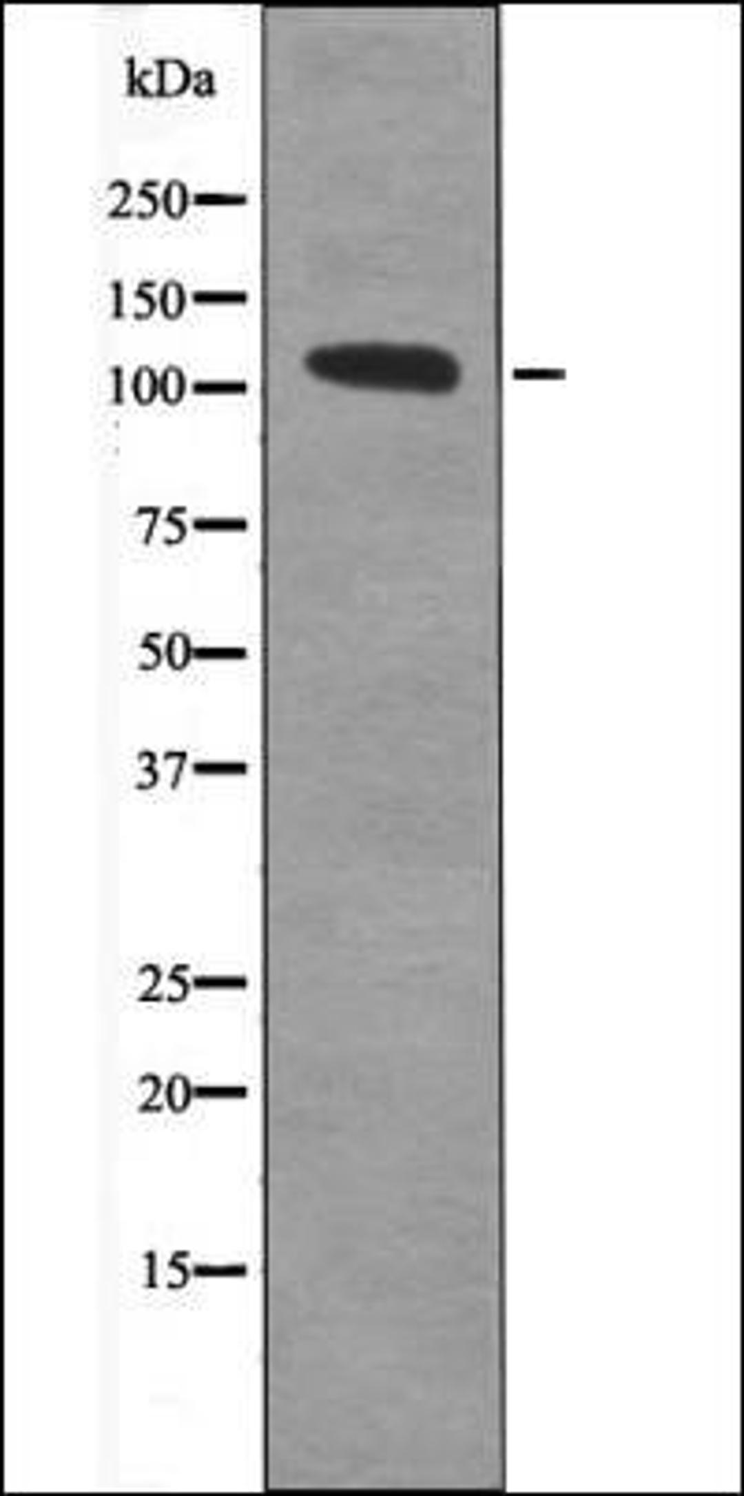 Western blot analysis of Forskolin treated HepG2 whole cell lysates using STAT2 -Phospho-Tyr631- antibody