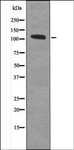 Western blot analysis of Forskolin treated HepG2 whole cell lysates using STAT2 -Phospho-Tyr631- antibody