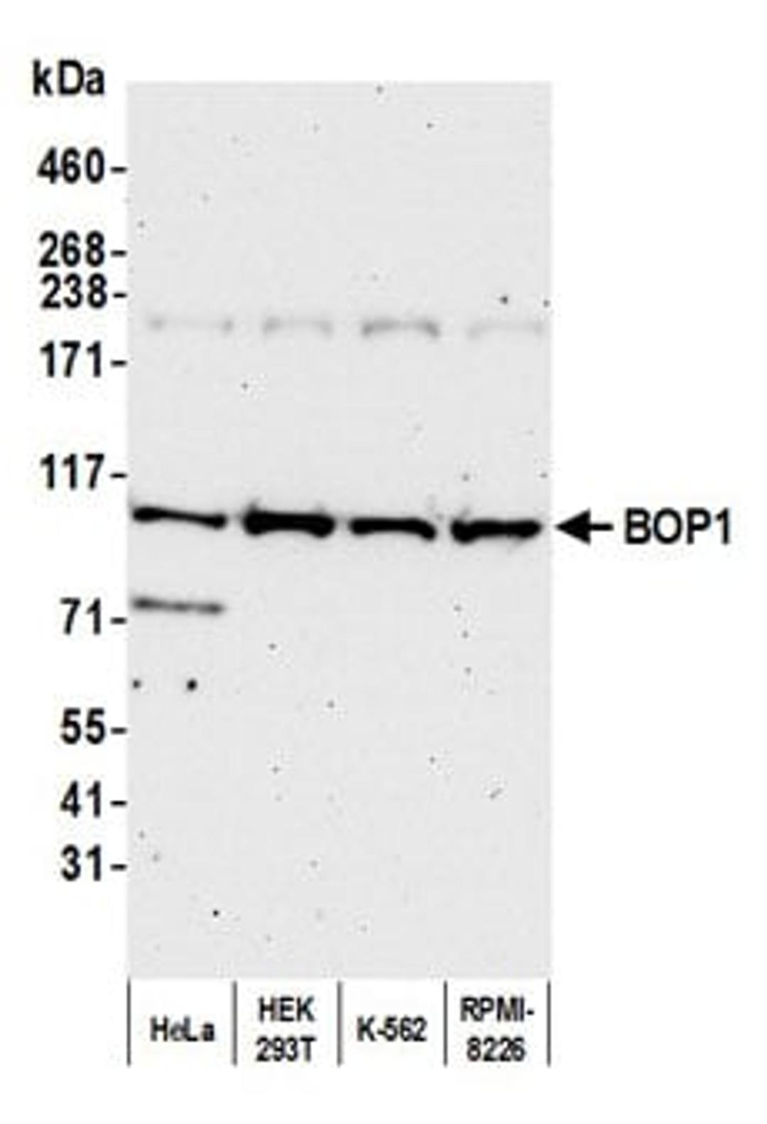 Detection of human BOP1 by western blot.