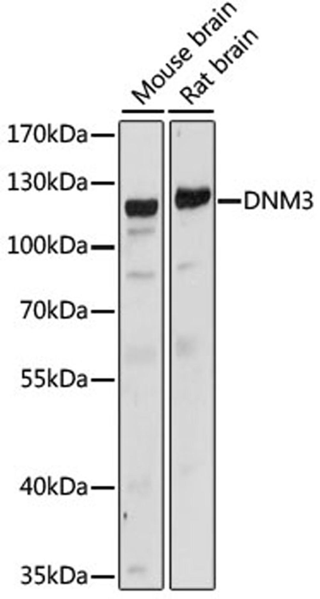 Western blot - DNM3 antibody (A15148)