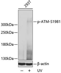 Western blot - Phospho-ATM-S1981 antibody (AP0008)