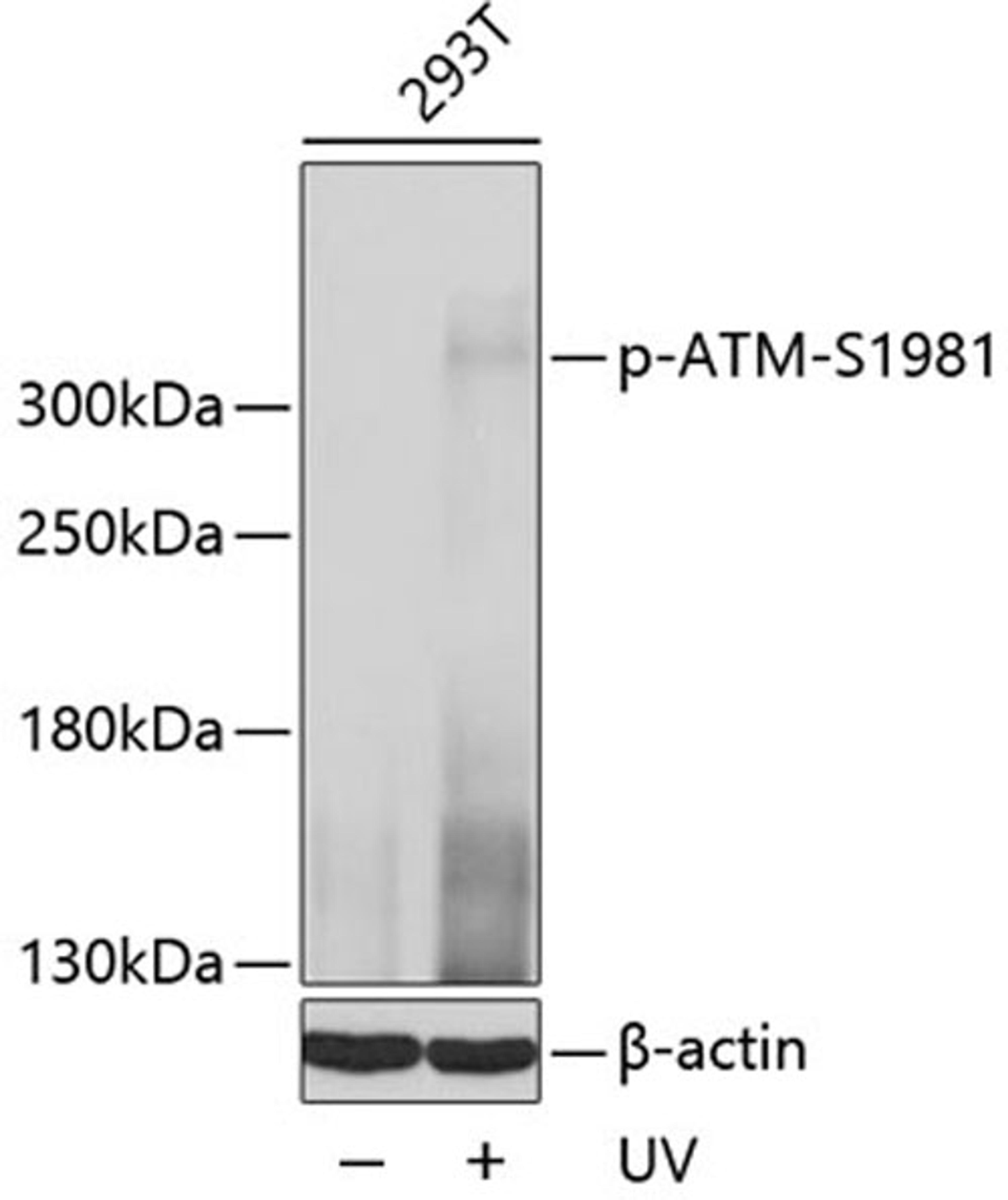 Western blot - Phospho-ATM-S1981 antibody (AP0008)