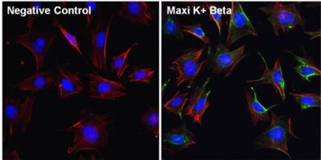 Immunofluorescence: Maxi Potassium channel beta Antibody [NB300-535] - Analysis of Maxi K+ Beta (green) in Movas cells. The cells were fixed with 4% paraformaldehyde for 15 minutes, permeabilized with 0.1% Triton X-100 in PBS for 10 minutes, and blocked with 3% BSA in PBS for 30 minutes at room temperature. Cells were stained with a Maxi K+ Beta polyclonal antibody at a dilution of 1:100 in staining buffer for 1 hour at room temperature, and then incubated with a Goat anti-Rabbit IgG (H+L) Secondary Antibody, Alexa Fluor 488 conjugate at a dilution of 1:1000 for 1 hour at room temperature (green). F-actin (red) was stained by Dylight 554 Phalloidin and Nuclei (blue) were stained with Hoechst dye.