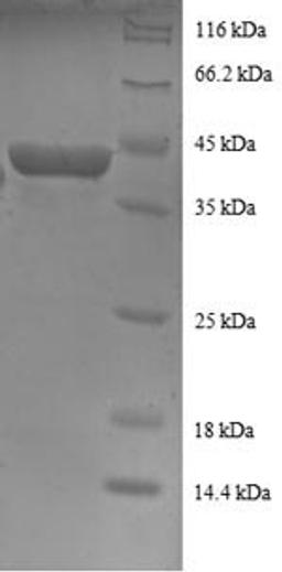 (Tris-Glycine gel) Discontinuous SDS-PAGE (reduced) with 5% enrichment gel and 15% separation gel.