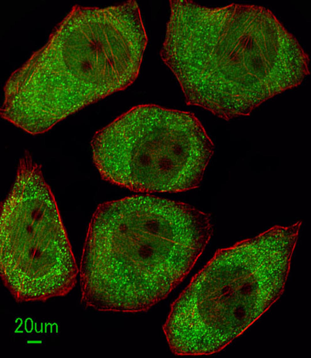 Immunofluorescent analysis of A549 cells, using ALOX12 Antibody. Antibody was diluted at 1:100 dilution. Alexa Fluor 488-conjugated goat anti-rabbit lgG at 1:400 dilution was used as the secondary antibody (green). Cytoplasmic actin was counterstained wit