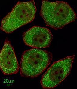 Immunofluorescent analysis of A549 cells, using ALOX12 Antibody. Antibody was diluted at 1:100 dilution. Alexa Fluor 488-conjugated goat anti-rabbit lgG at 1:400 dilution was used as the secondary antibody (green). Cytoplasmic actin was counterstained wit