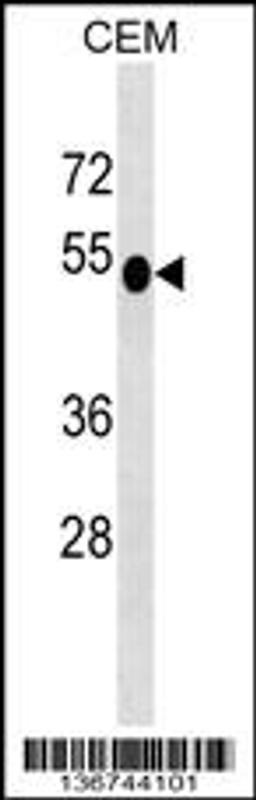 Western blot analysis in CEM cell line lysates (35ug/lane).