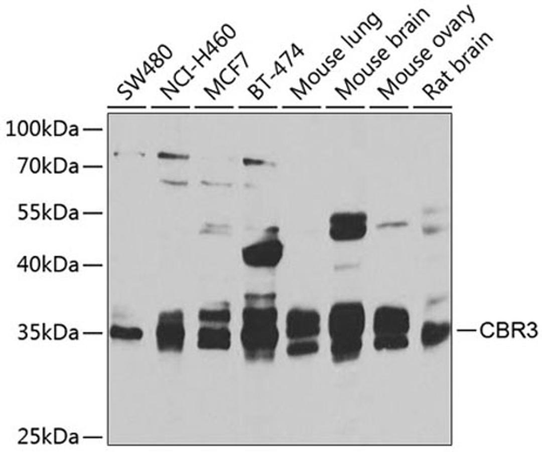 Western blot - CBR3 antibody (A7545)