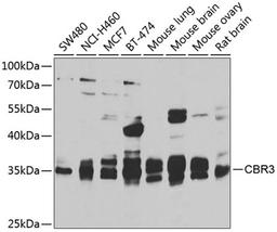 Western blot - CBR3 antibody (A7545)