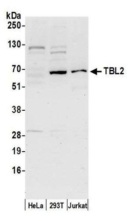 Detection of human TBL2 by WB.