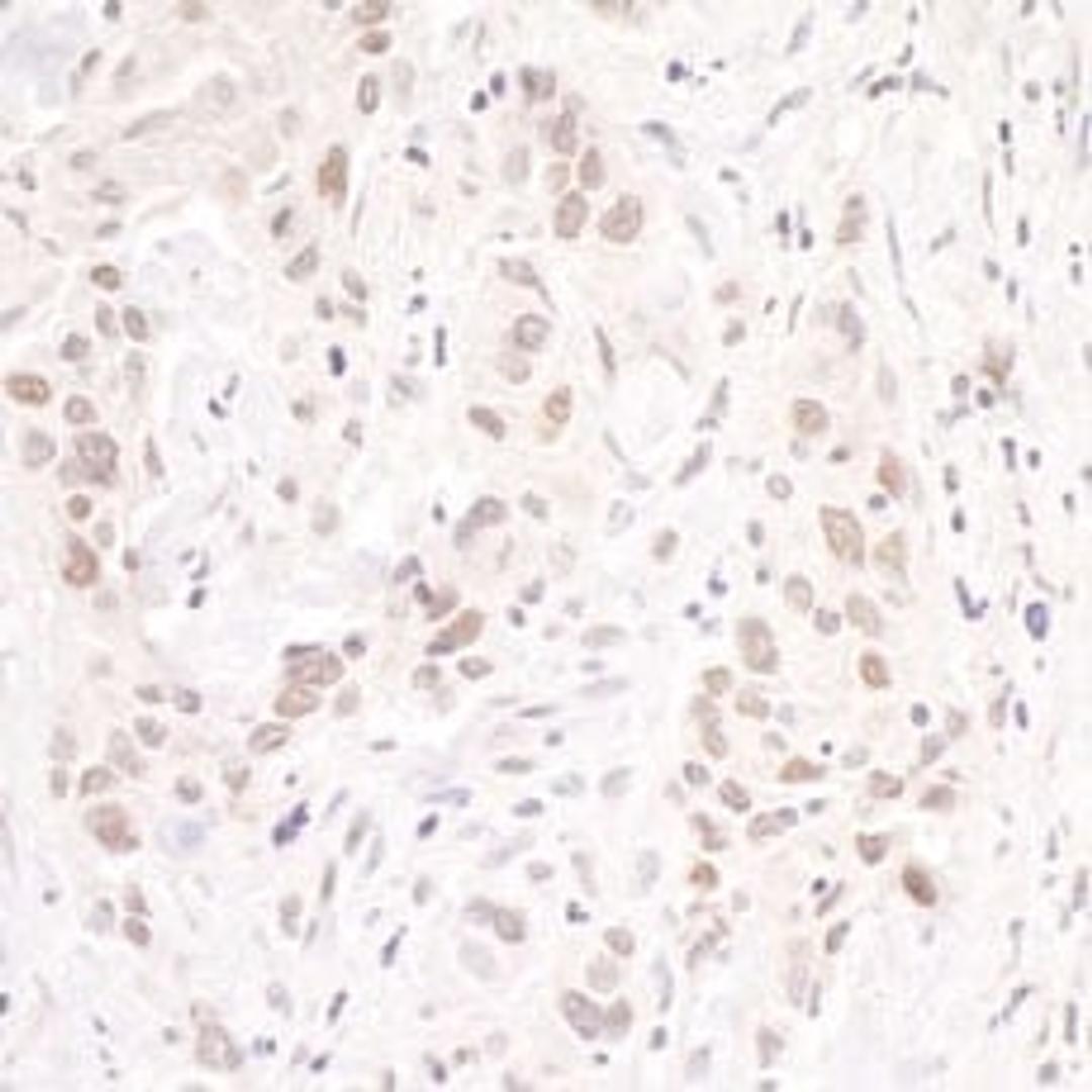 Detection of human p66beta/GATAD2B by immunohistochemistry.