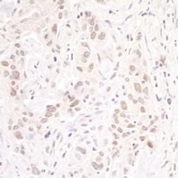 Detection of human p66beta/GATAD2B by immunohistochemistry.