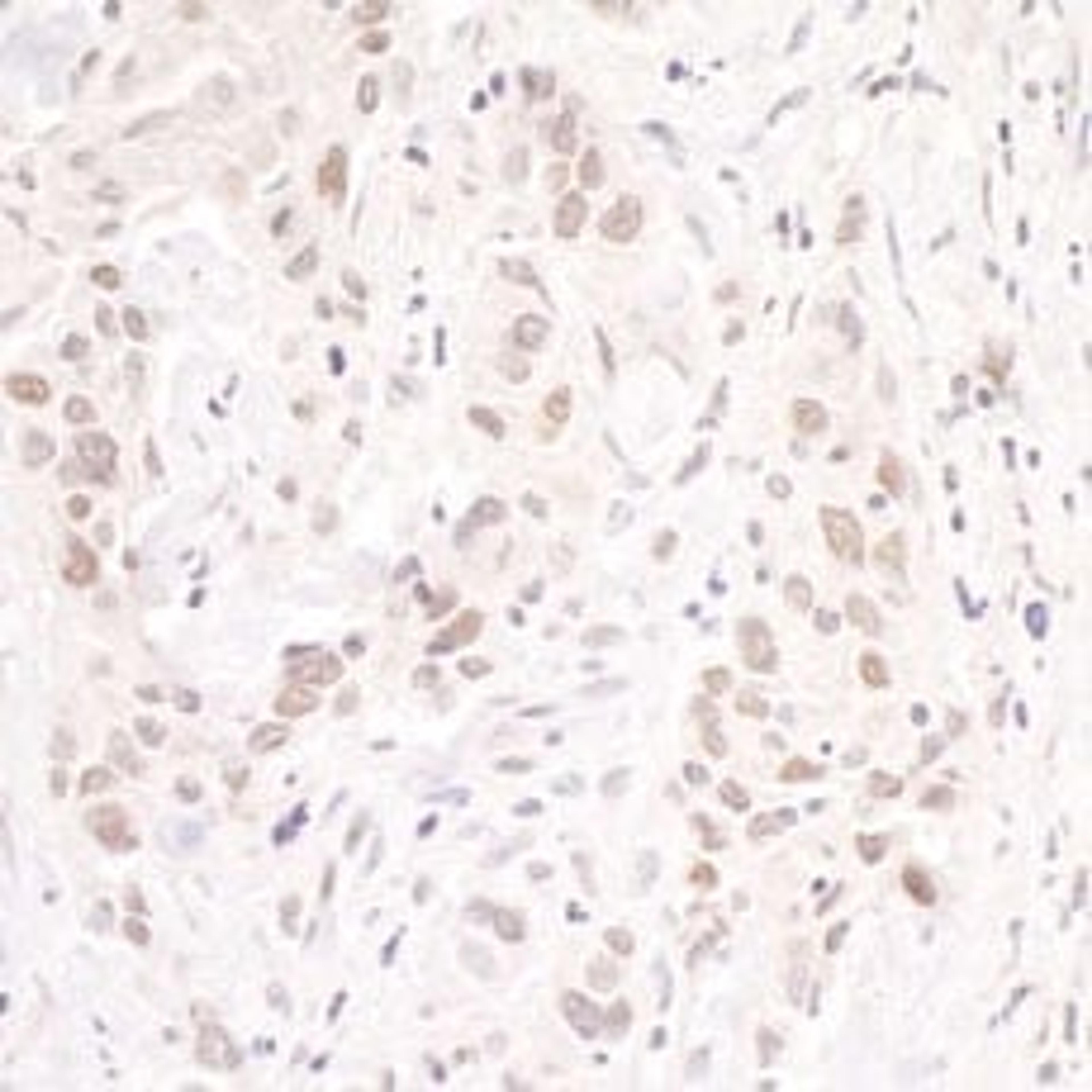 Detection of human p66beta/GATAD2B by immunohistochemistry.