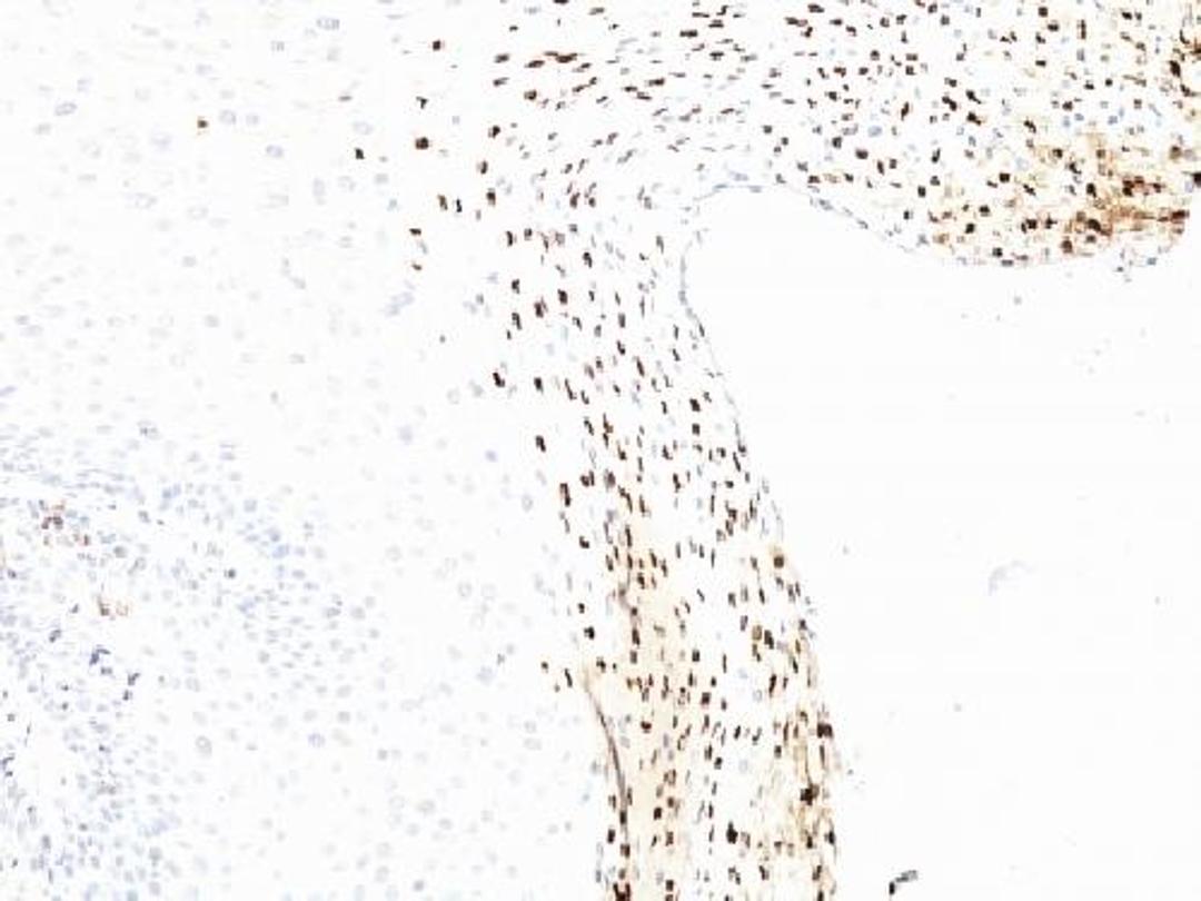 Immunohistochemical staining of human Cervix tissue using HPV-16 antibody