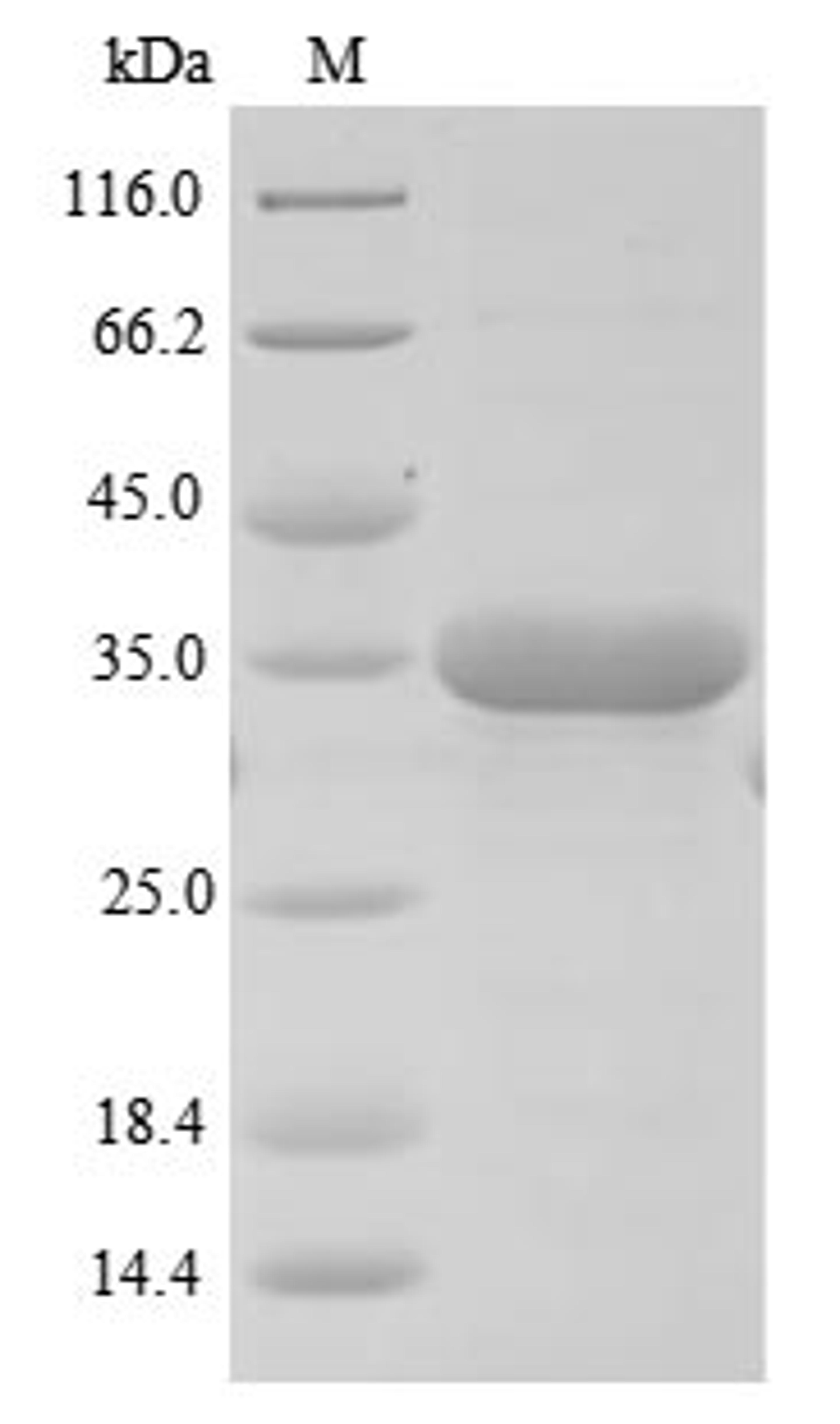 (Tris-Glycine gel) Discontinuous SDS-PAGE (reduced) with 5% enrichment gel and 15% separation gel.