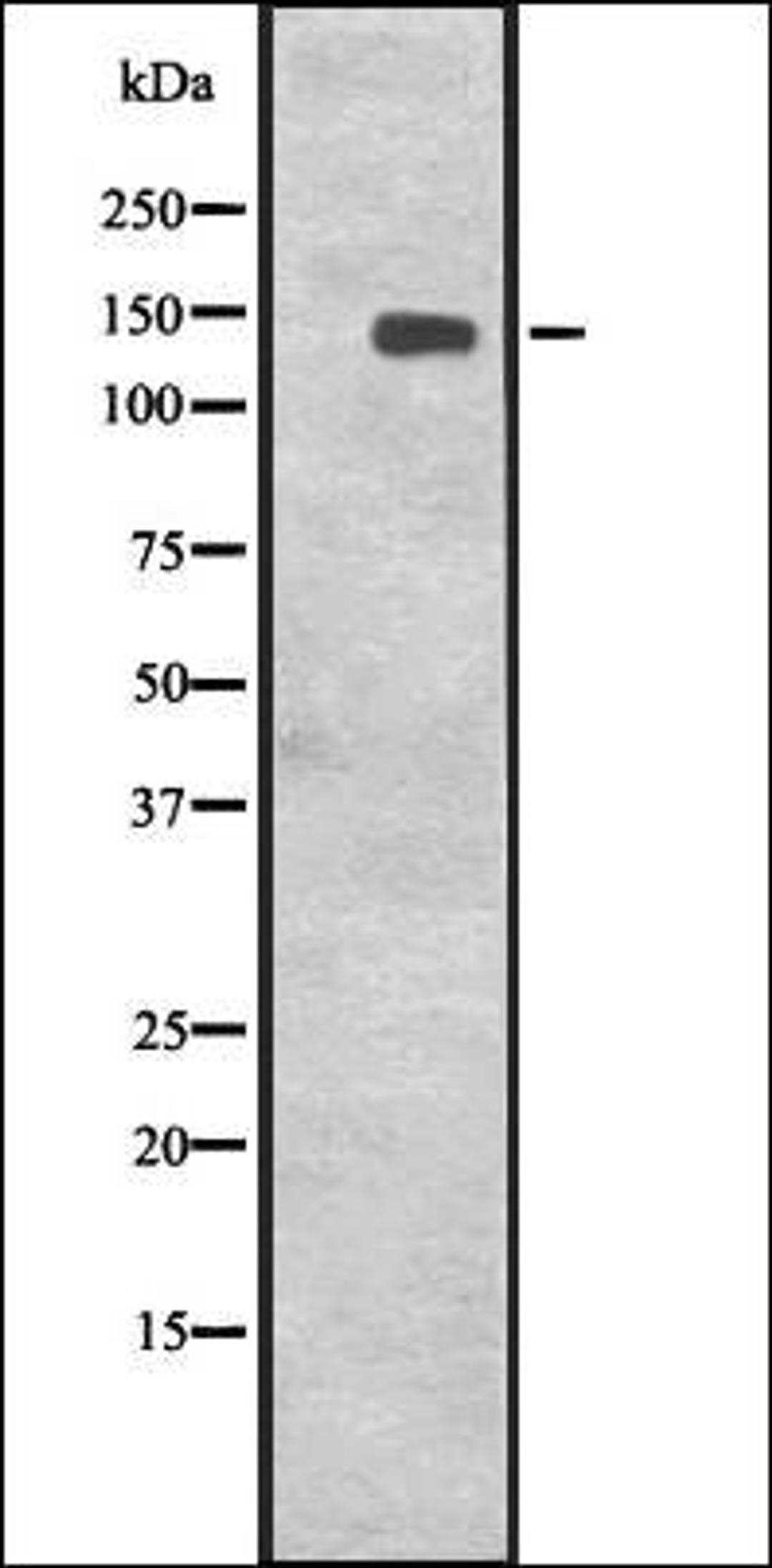 Western blot analysis of Jurkat cell lysate using CENPJ antibody