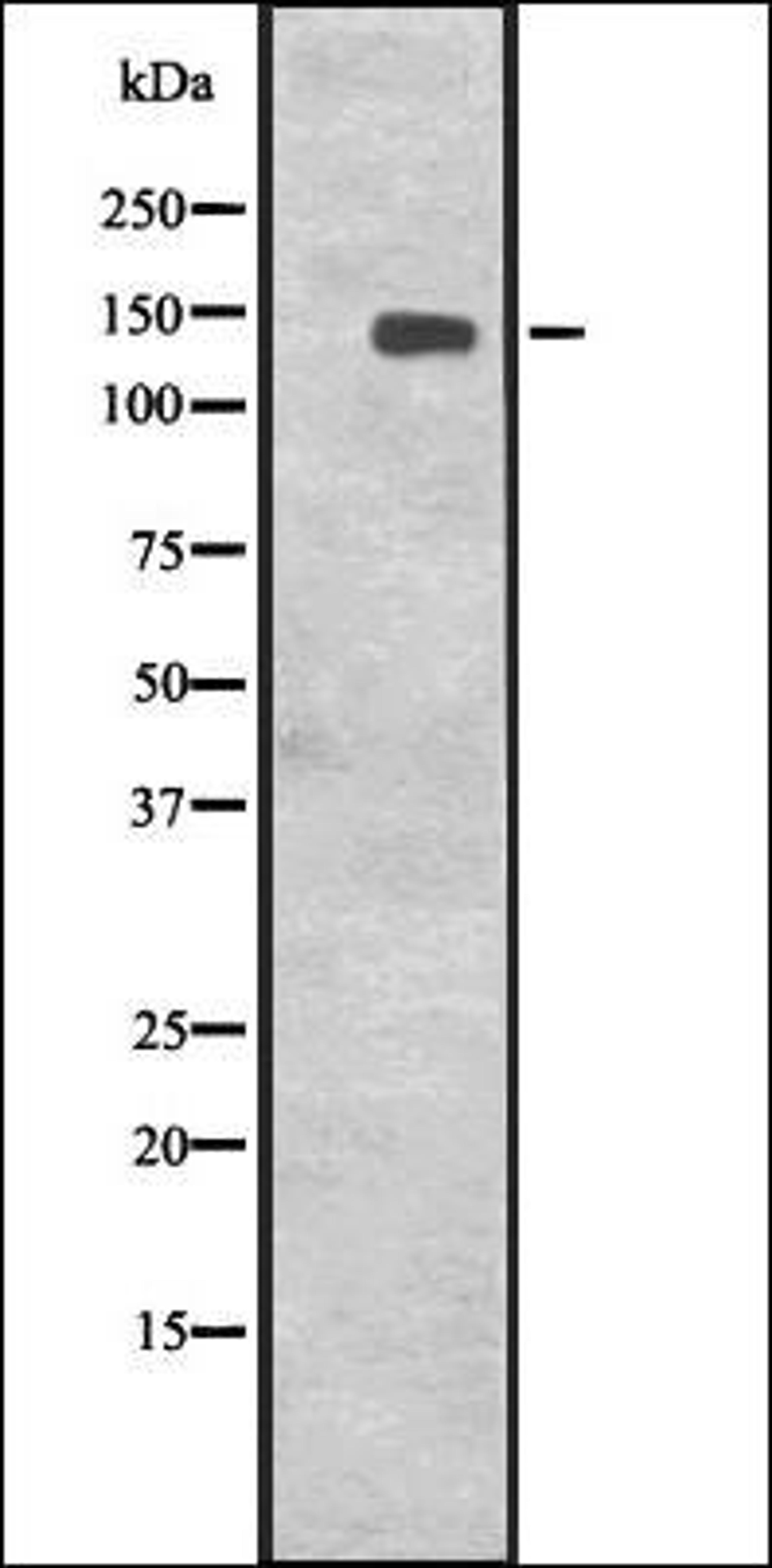 Western blot analysis of Jurkat cell lysate using CENPJ antibody