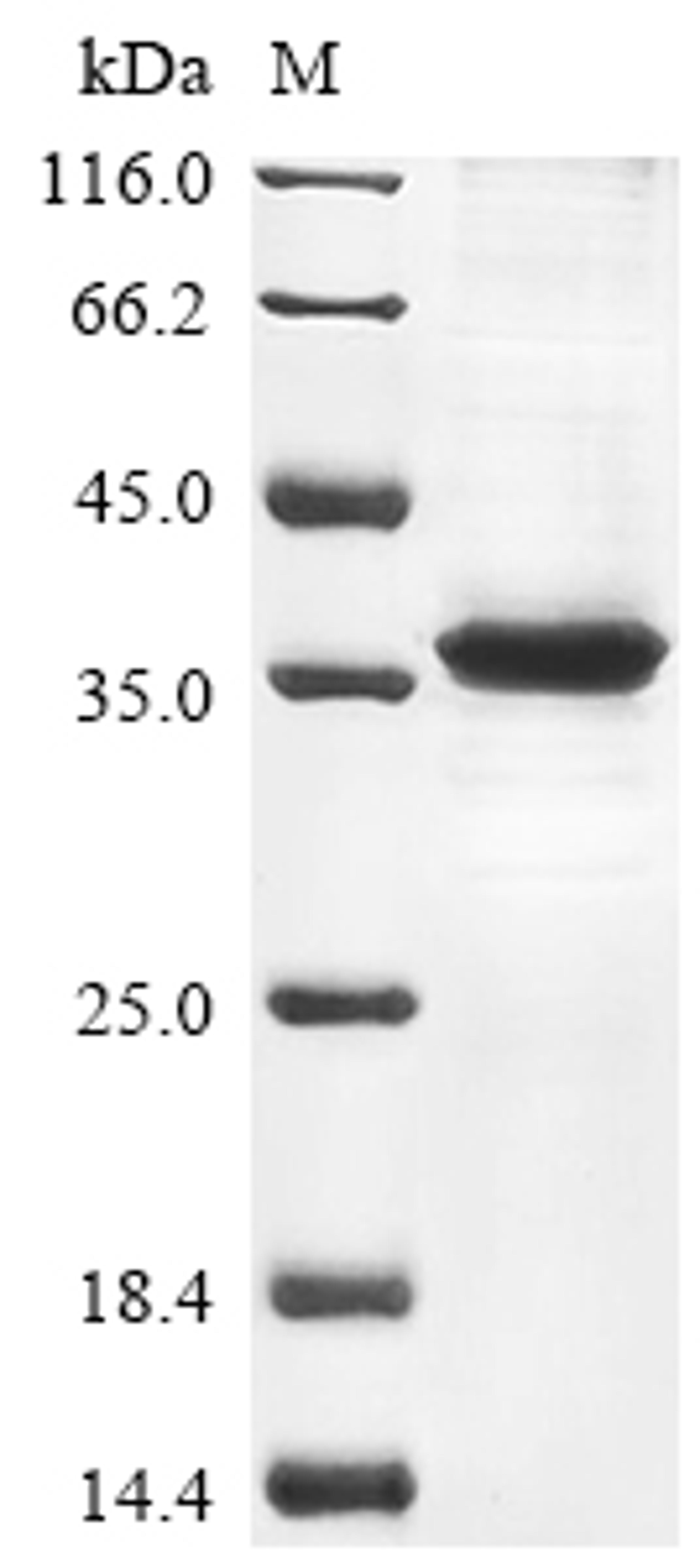 (Tris-Glycine gel) Discontinuous SDS-PAGE (reduced) with 5% enrichment gel and 15% separation gel.