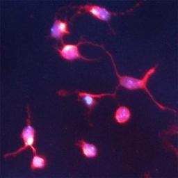 Immunocytochemistry/Immunofluorescence: Piccolo Antibody [NBP1-03406] - IF on 1 day-old mouse cortical cell culture using Rabbit antibody to internal part of Piccolo (Aczonin): whole serum at 1: 2000 dilution. DAPI counter stained appearing in blue.