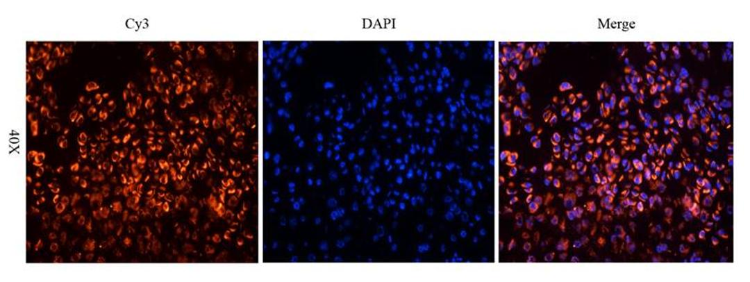 Immunofluorescence analysis of mouse bone marrow tissue using Gremlin 1 antibody (dilution of primary antibody - 2.5 ug/ml)