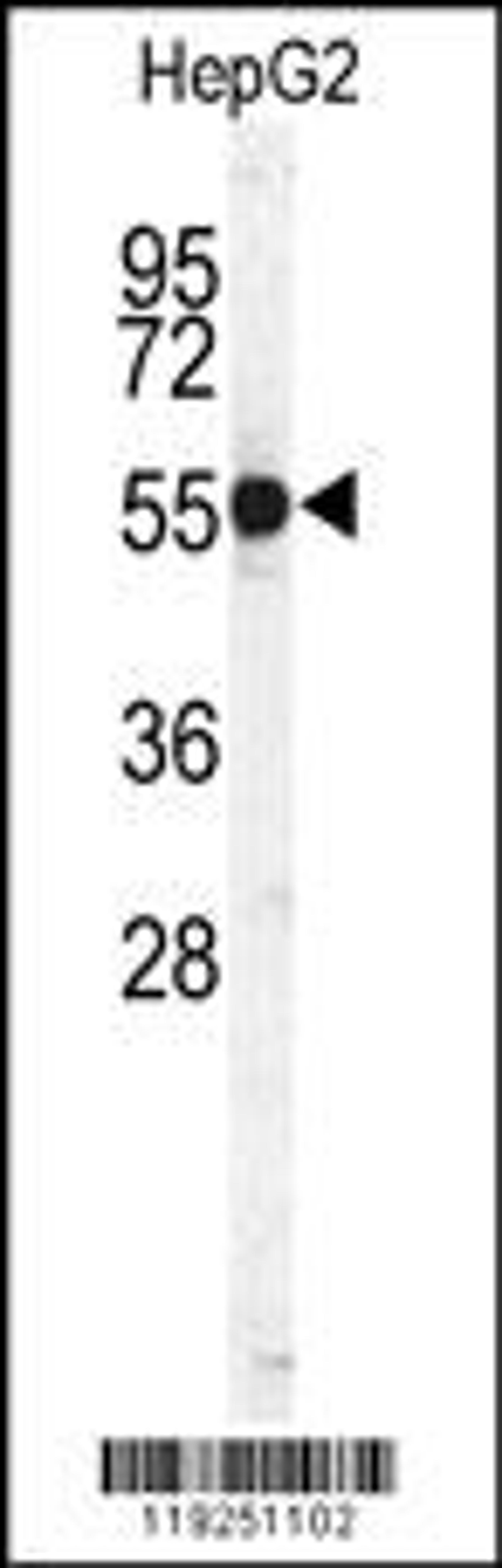 Western blot analysis of CTSH Antibody in HepG2 cell line lysates (35ug/lane)