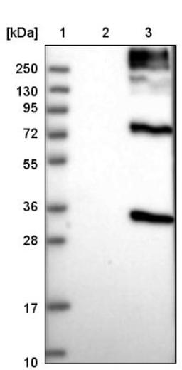 Western Blot: BTG3 Antibody [NBP1-89098] - Lane 1: Marker [kDa] 250, 130, 95, 72, 55, 36, 28, 17, 10<br/>Lane 2: Negative control (vector only transfected HEK293T lysate)<br/>Lane 3: Over-expression lysate (Co-expressed with a C-terminal myc-DDK tag (~3.1 kDa) in mammalian HEK293T cells, LY416410)