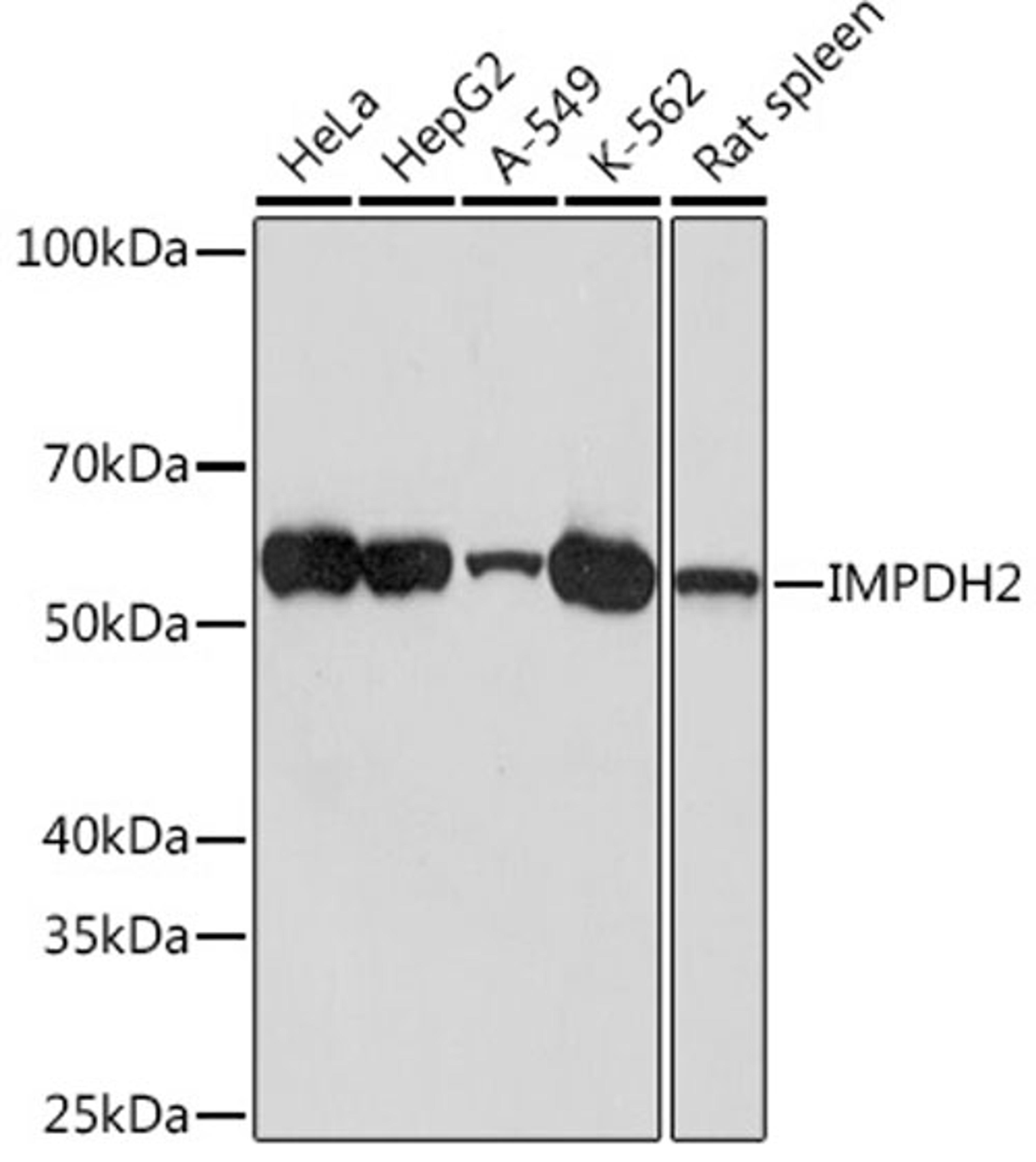 Western blot - IMPDH2 Rabbit mAb (A9208)