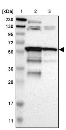 Western Blot: HIV-1 Rev binding protein (HRB) Antibody [NBP1-91991] - Lane 1: Marker [kDa] 230, 130, 95, 72, 56, 36, 28, 17, 11<br/>Lane 2: Human cell line RT-4<br/>Lane 3: Human cell line U-251MG sp