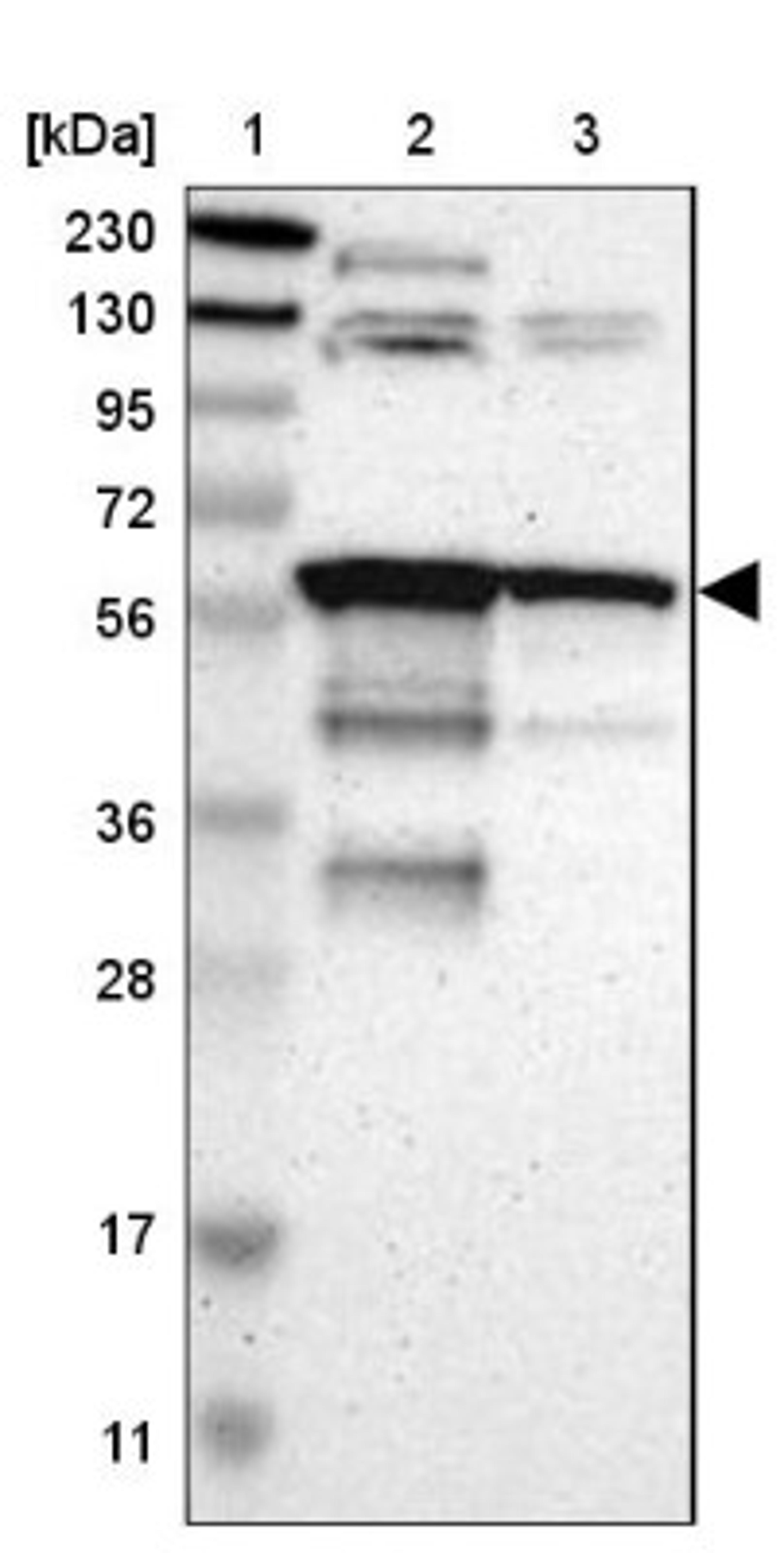 Western Blot: HIV-1 Rev binding protein (HRB) Antibody [NBP1-91991] - Lane 1: Marker [kDa] 230, 130, 95, 72, 56, 36, 28, 17, 11<br/>Lane 2: Human cell line RT-4<br/>Lane 3: Human cell line U-251MG sp