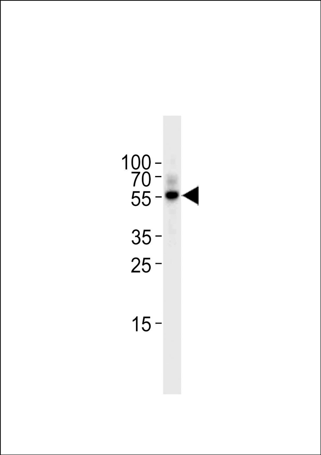 Western blot analysis in Raji cell line lysates (35ug/lane).