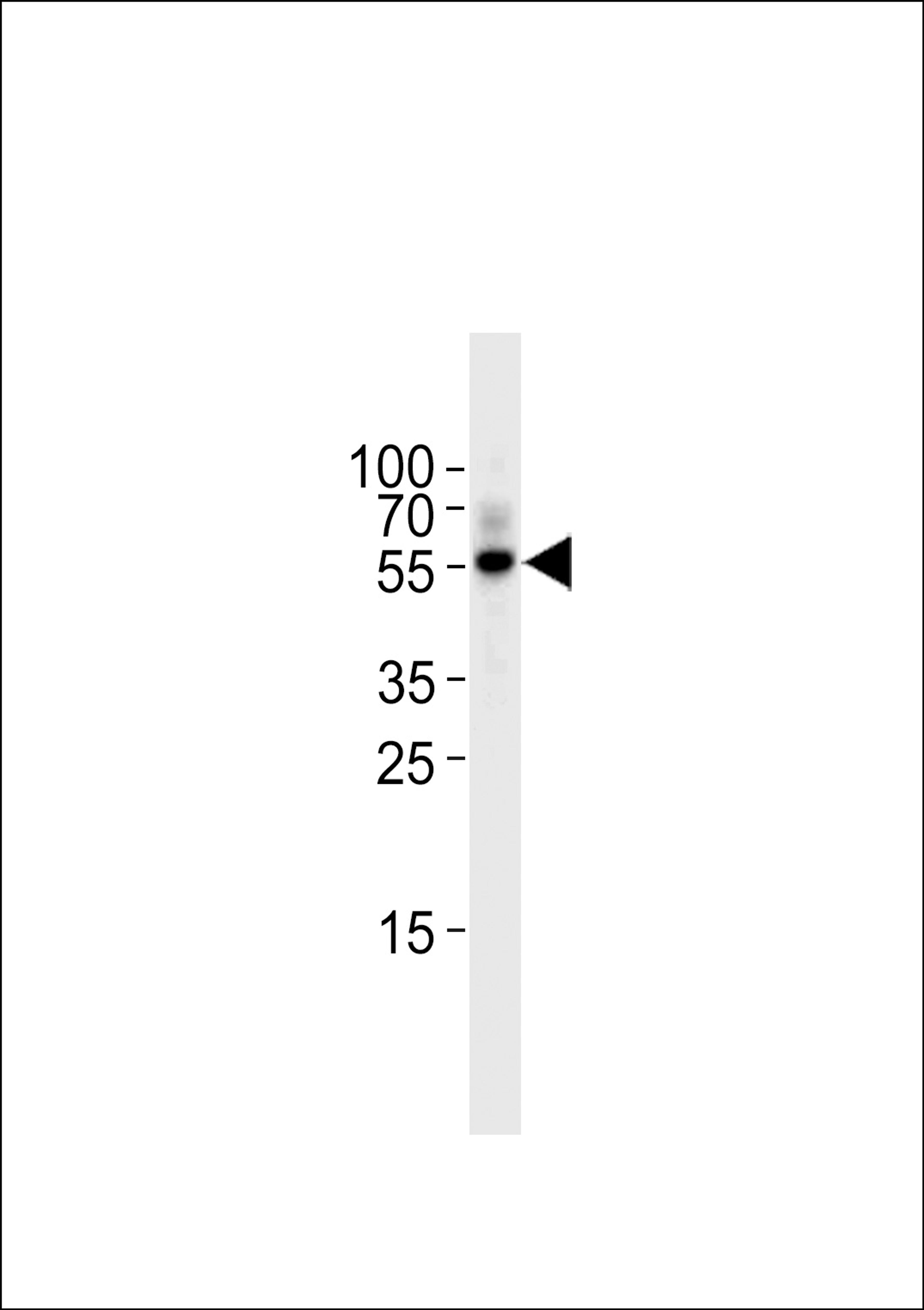 Western blot analysis in Raji cell line lysates (35ug/lane).