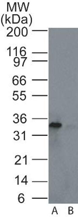 Western Blot: Rad1 Antibody [NB100-56320] - Western blot analysis of Rad1 in A) HeLa and B) HEK293 cell lysate using Rad1 antibody at 4 ug/ml.