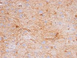 Immunohistochemistry-Paraffin: GFAP Antibody (GA5) [NBP2-29415] - Formalin-paraffin human brain stained with GFAP Ab (GA-5). Note cytoplasmic staining.