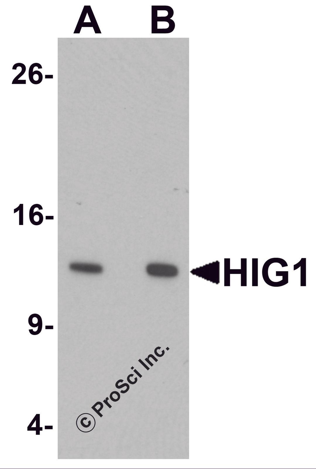 Western blot analysis of HIG1 in 293 cell lysate with HIG1 antibody at at (A) 0.5 and (B) 1 μg/mL.