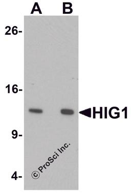 Western blot analysis of HIG1 in 293 cell lysate with HIG1 antibody at at (A) 0.5 and (B) 1 μg/mL.
