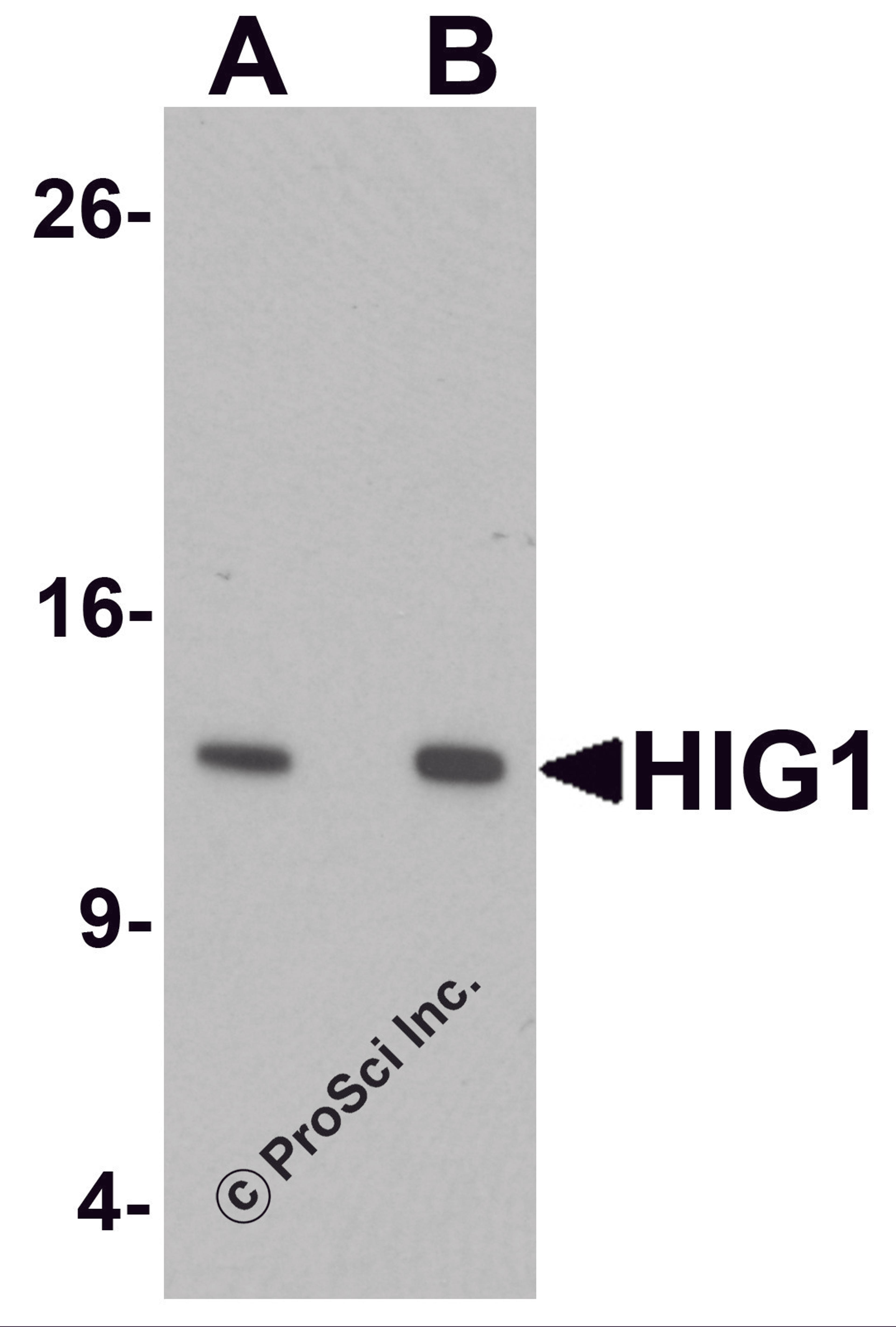 Western blot analysis of HIG1 in 293 cell lysate with HIG1 antibody at at (A) 0.5 and (B) 1 μg/mL.