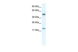 Antibody used in WB on Human Jurkat 0.2-1 ug/ml.