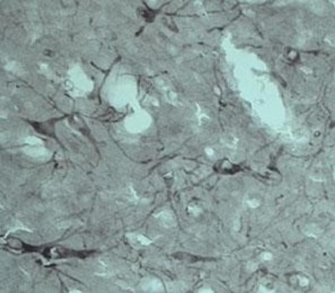 Immunohistochemistry-Paraffin: VPS45 Antibody [NB100-98931] - IHC on rat brain using Rabbit antibody to internal part of Vacuolar protein sorting-associated protein 45 (rvps45, Vps45, Vps45a): IgG  at a concentration of 10 ug/ml.