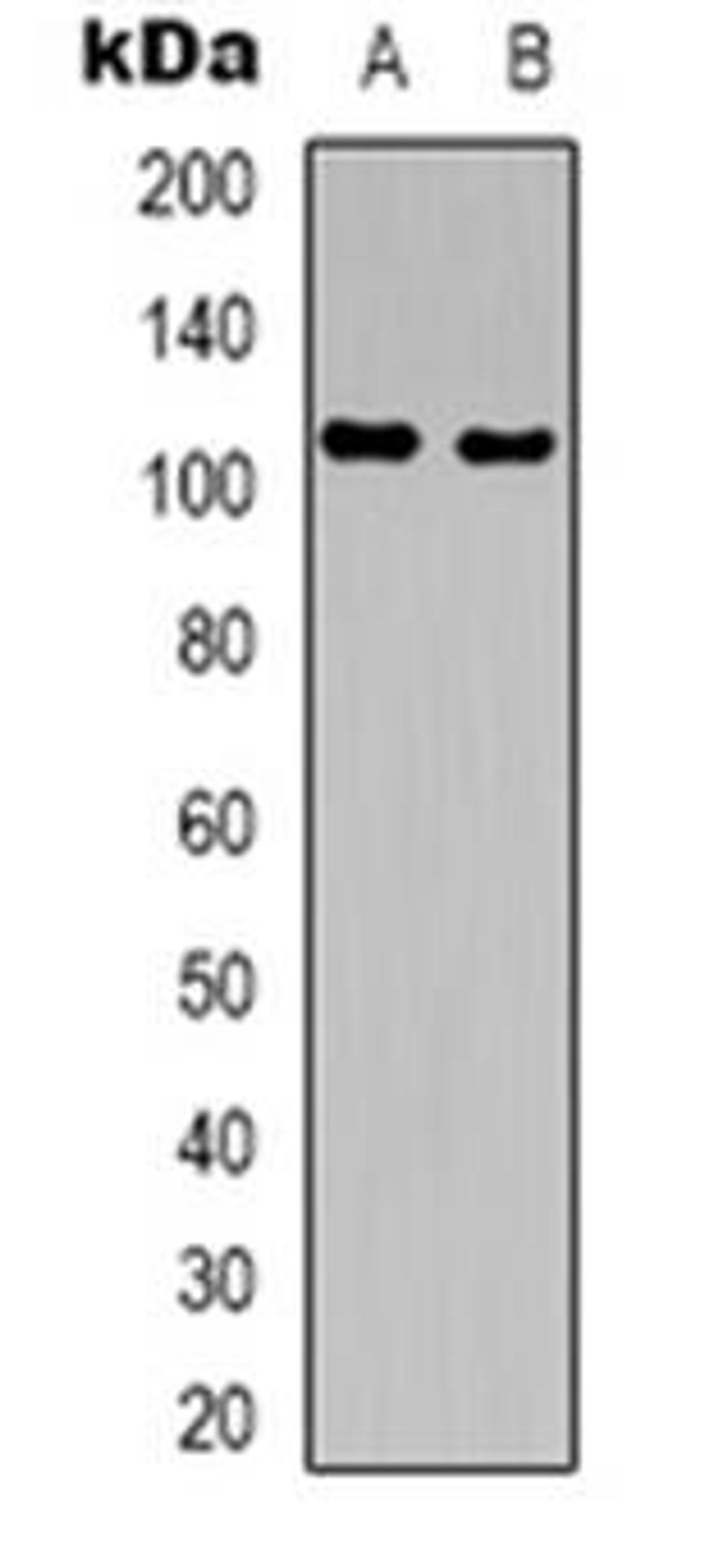 Western blot analysis of GTF2IRD1 expression in Hela (Lane 1), HEK293T (Lane 2) whole cell lysates using GTF2IRD1 antibody