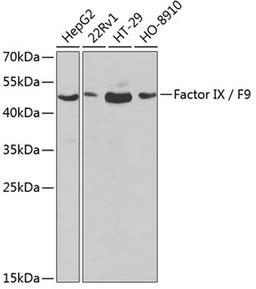 Western blot - Factor IX / F9  antibody (A1578)