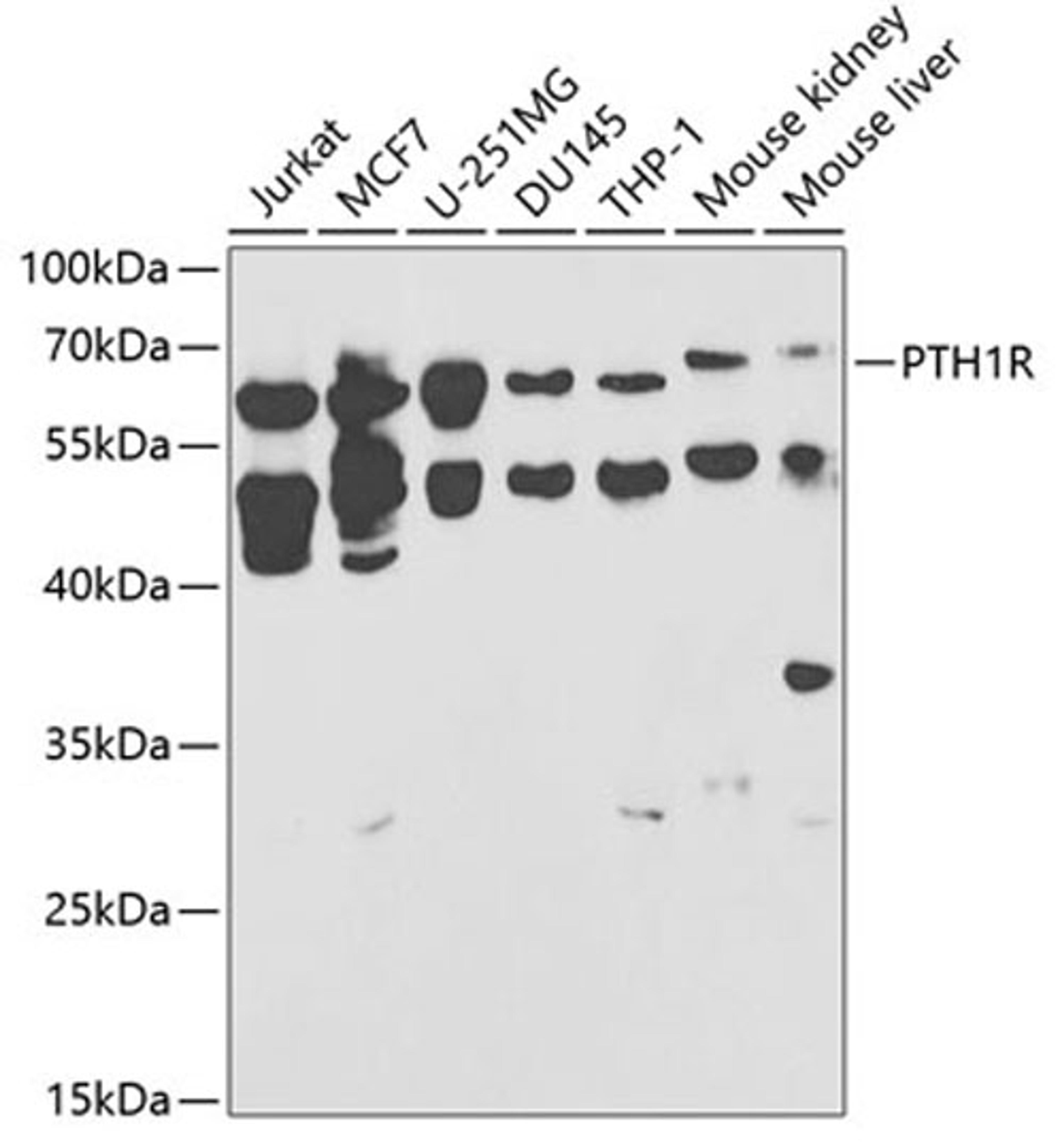 Western blot - PTH1R antibody (A1744)