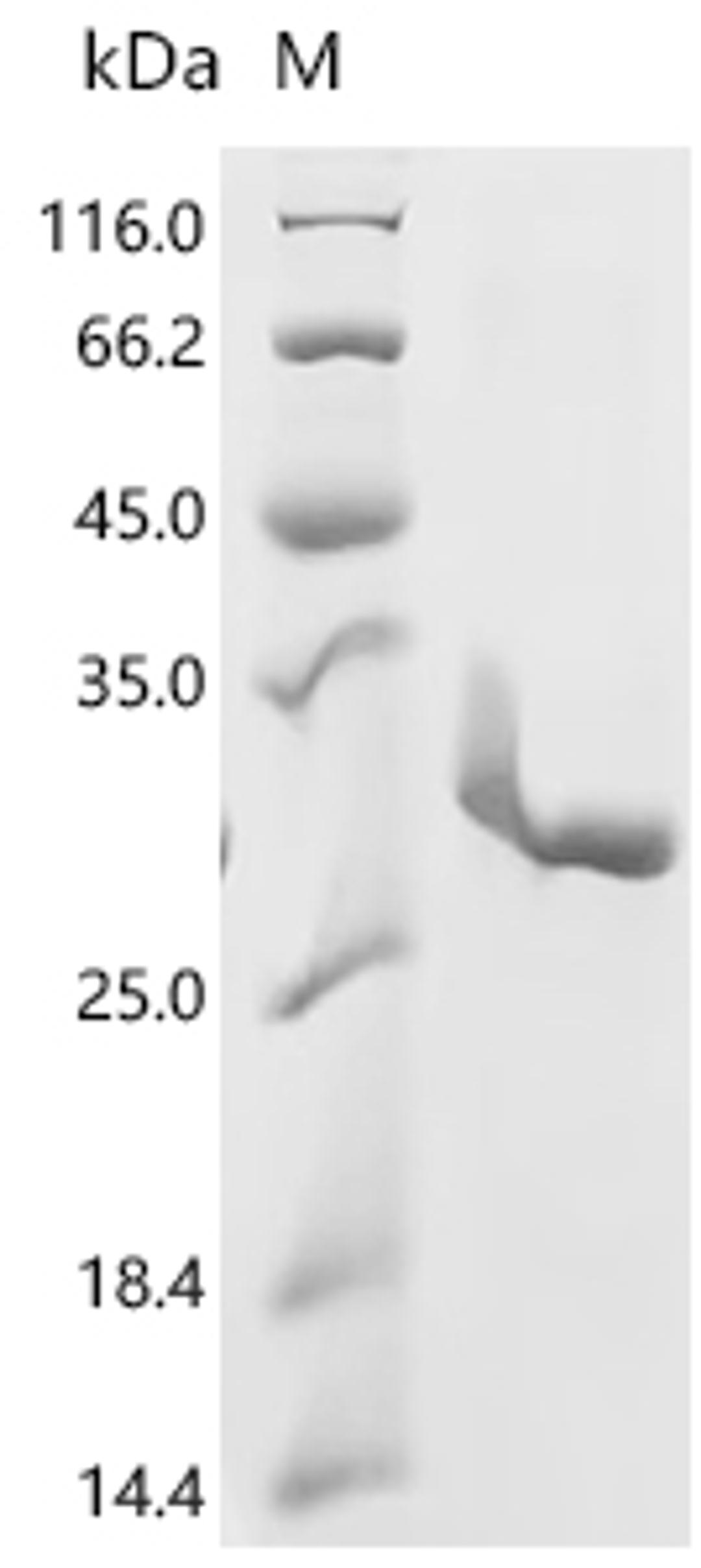 (Tris-Glycine gel) Discontinuous SDS-PAGE (reduced) with 5% enrichment gel and 15% separation gel.