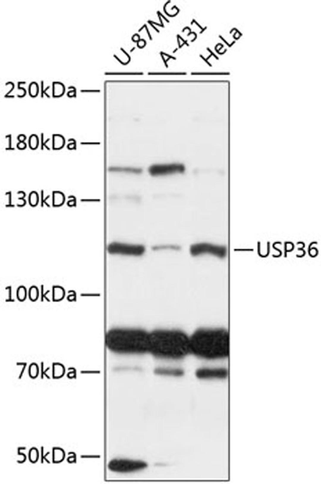 Western blot - USP36 antibody (A13115)