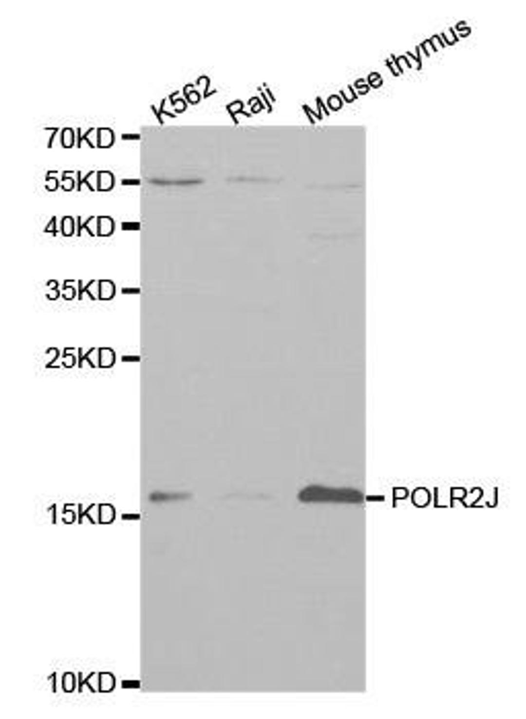 Western blot analysis of extracts of various cell lines using POLR2J antibody