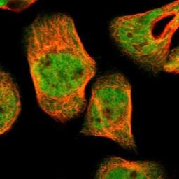 Immunocytochemistry/Immunofluorescence: UBE2Z Antibody [NBP1-82245] - Staining of human cell line A-431 shows positivity in nucleus but not nucleoli & cytoplasm.