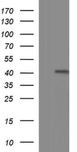 Western Blot: TXNDC5 Antibody (2E6) [NBP2-46256] - Analysis of HEK293T cells were transfected with the pCMV6-ENTRY control (Left lane) or pCMV6-ENTRY TXNDC5.